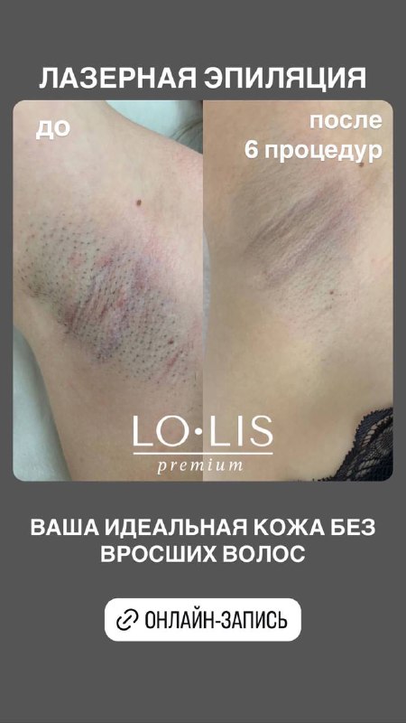 Центр красоты LO.LIS