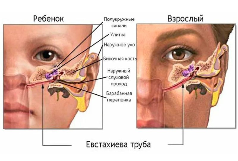 Где слуховая труба ***⬆️***