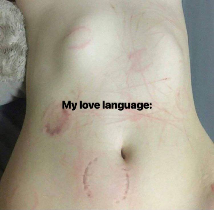 ﹙☠️﹚ ݂ ׂ ִ