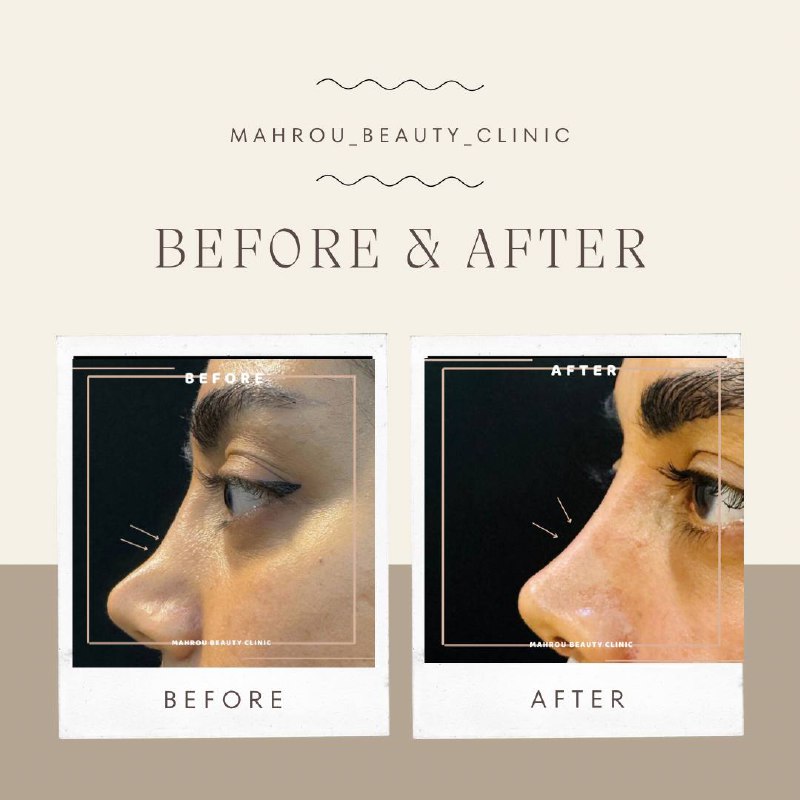 Mahrou_beauty_clinic 👄💉