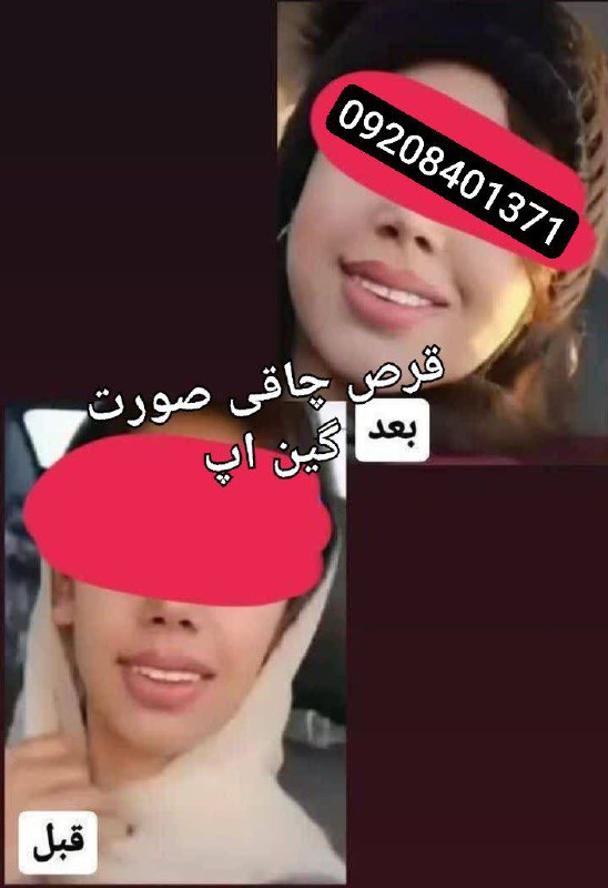 رضایت مشتری گلم از قرص گین …