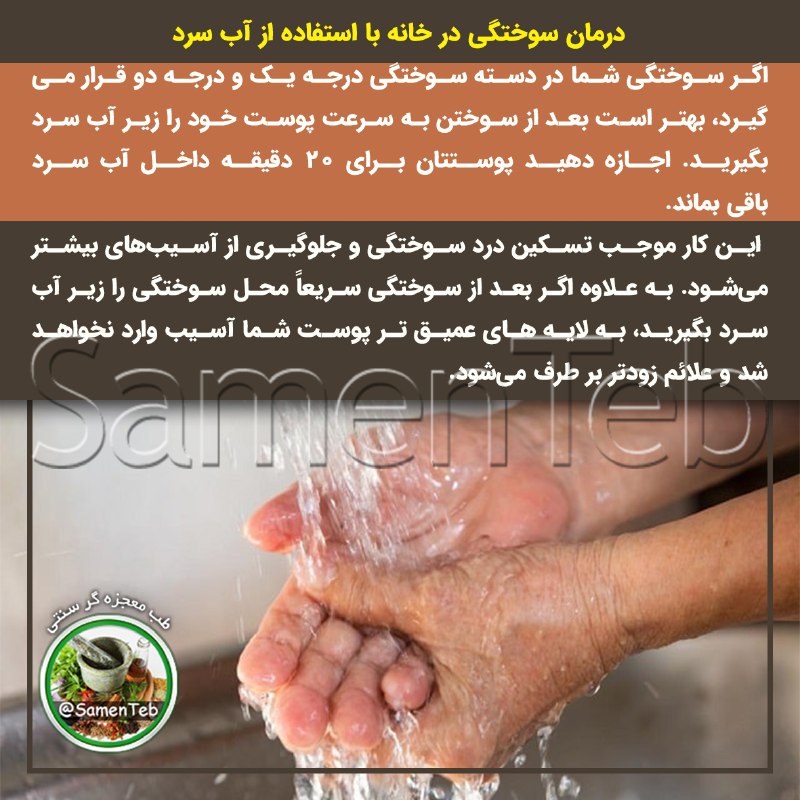 ***?***درمان [#سوختگی](?q=%23%D8%B3%D9%88%D8%AE%D8%AA%DA%AF%DB%8C) در خانه با استفاده …