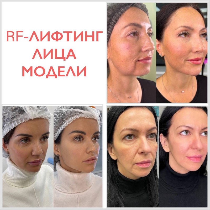 ***🙋🏼‍♀️*** **МОДЕЛИ НА ОМОЛОЖЕНИЕ И ЛИФТИНГ …