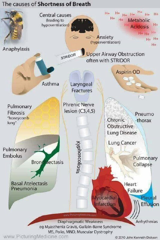 Causes of shortness of breath. ***📚***