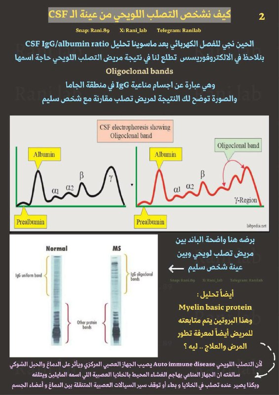 كيف نشخص مرض التصلب اللويحي multiple …