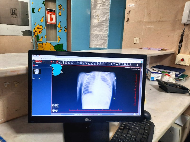 **Cardiomegaly*****🫀*** [Pediatrics]