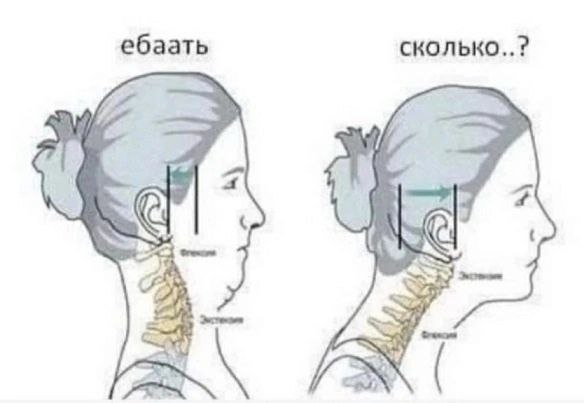 Мемфикс