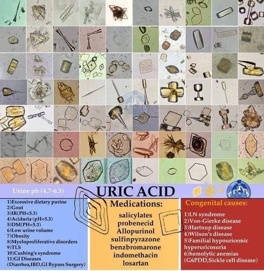 Uric Acid