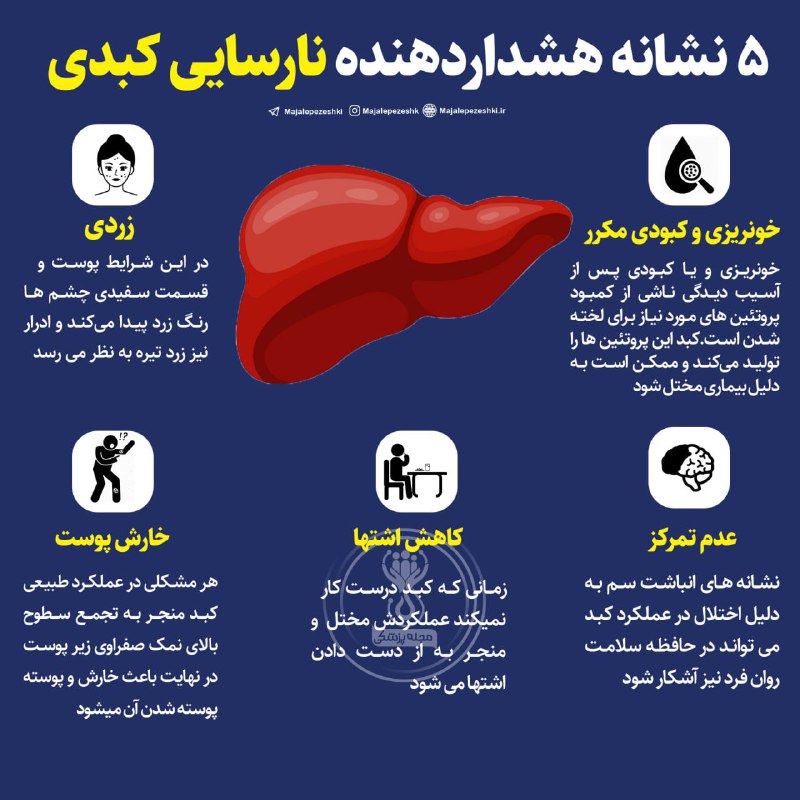 **۵ نشانه نارایی کبد***❗️*****