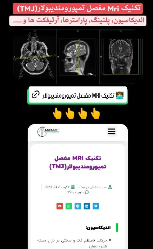 [#تکنیک\_Mri](?q=%23%D8%AA%DA%A9%D9%86%DB%8C%DA%A9_Mri)