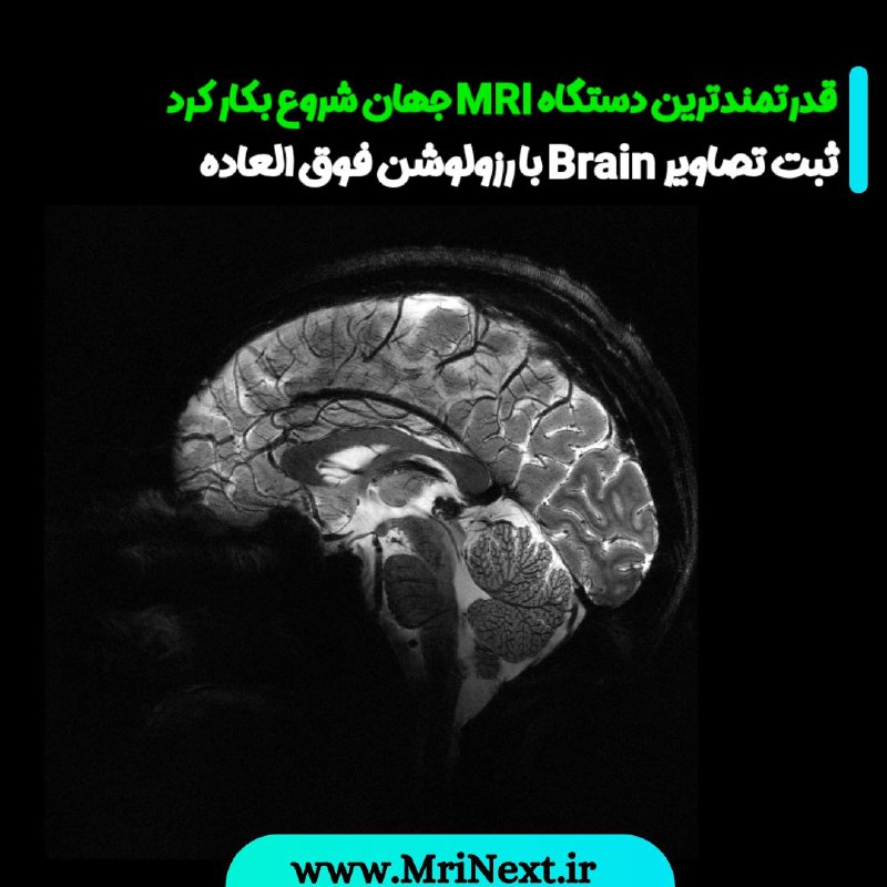 ***✅*** **ثبت اولین تصویر Brain انسان …