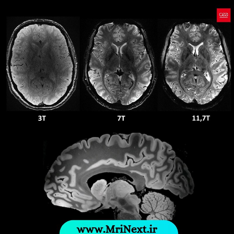 آموزش MRI (وب سایت MriNext)