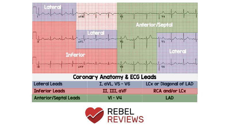 Coronary arteries in the ECG leads …