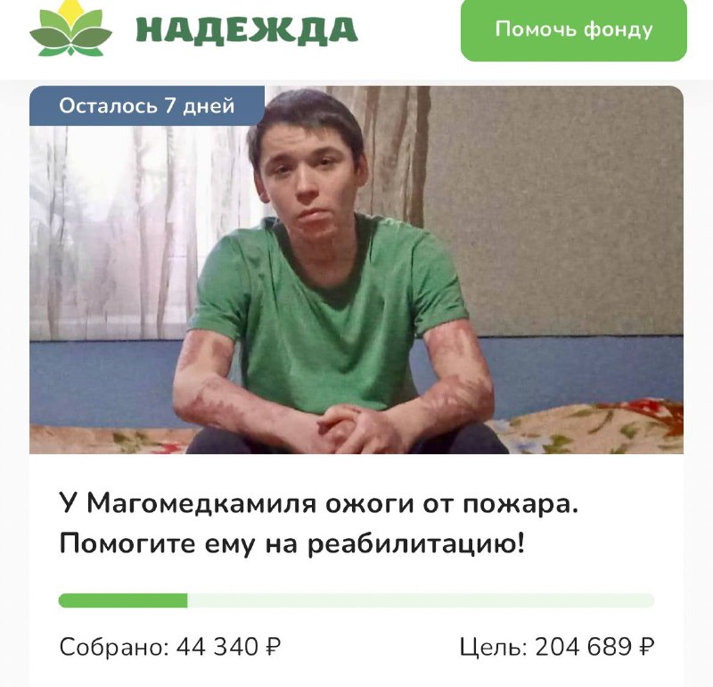 ***📢*** 15-летний Магомедкамиль мучается от ожогов!