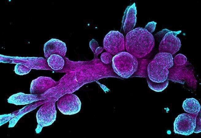 *****🔬***Клетки молочной железы под микроскопом.**