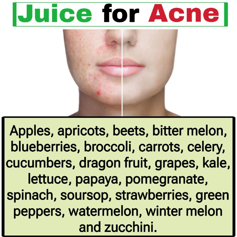 **Juice for Acne**