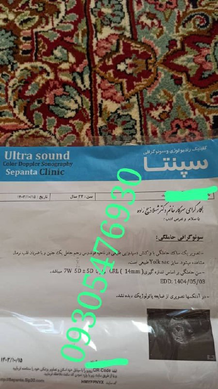 **خبرخوش بارداری مبارکشون باشه