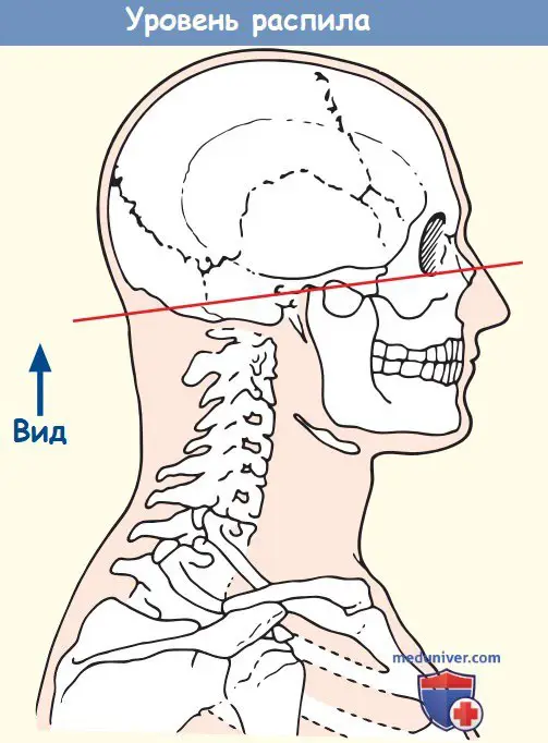 Анатомия аксиального среза головы через верхнечелюстную …