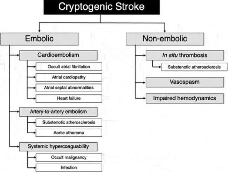 Cryptogenic stroke has been hypothesized to …