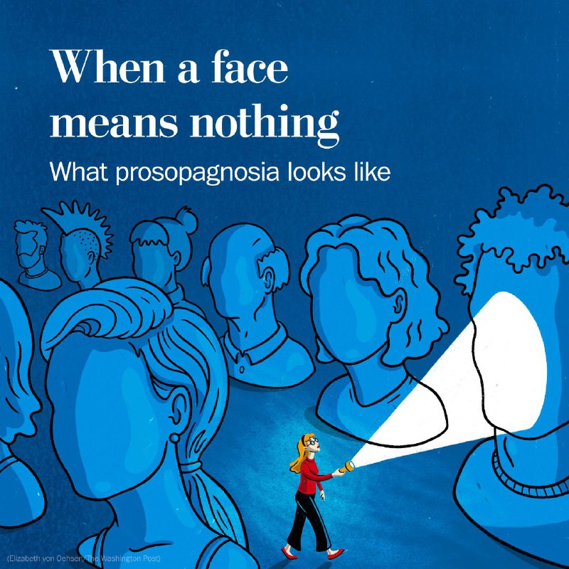 Prosopagnosia is **a condition where you …