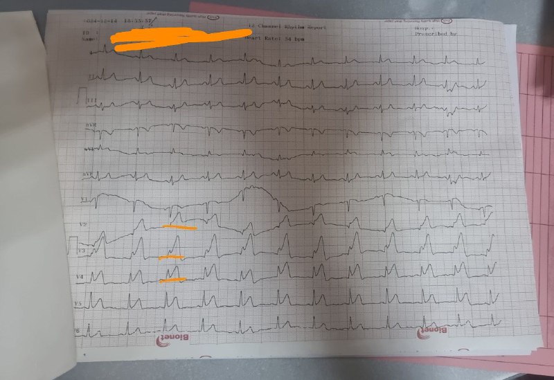 یه STEMI نشه؟!