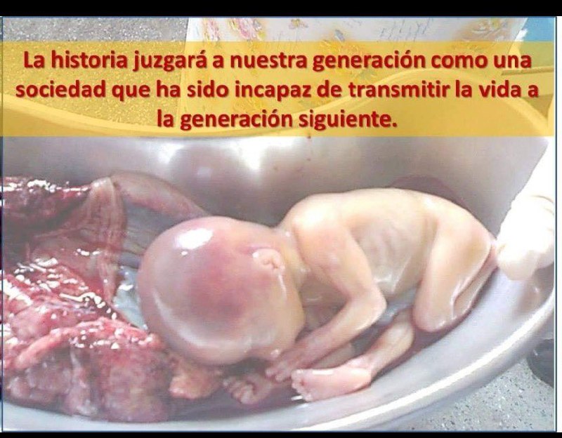 NO AL ABORTO