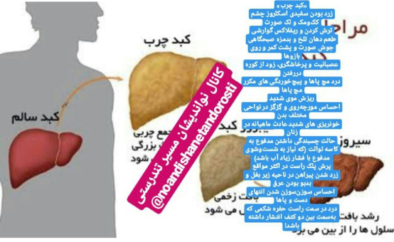 ***⏪*** کبد چرب***🥗******🥙******🍋******🍌***