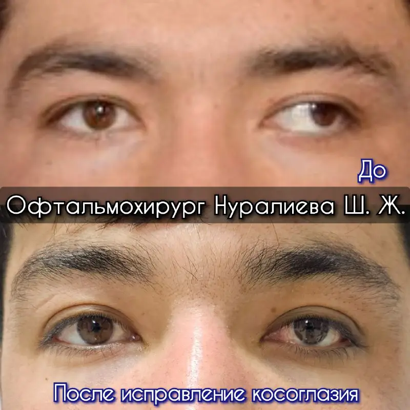 Окулист, офтальмолог Нуралиева Ш. Ж.