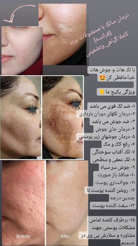 ***?***زیبایی را با ما به اوج …