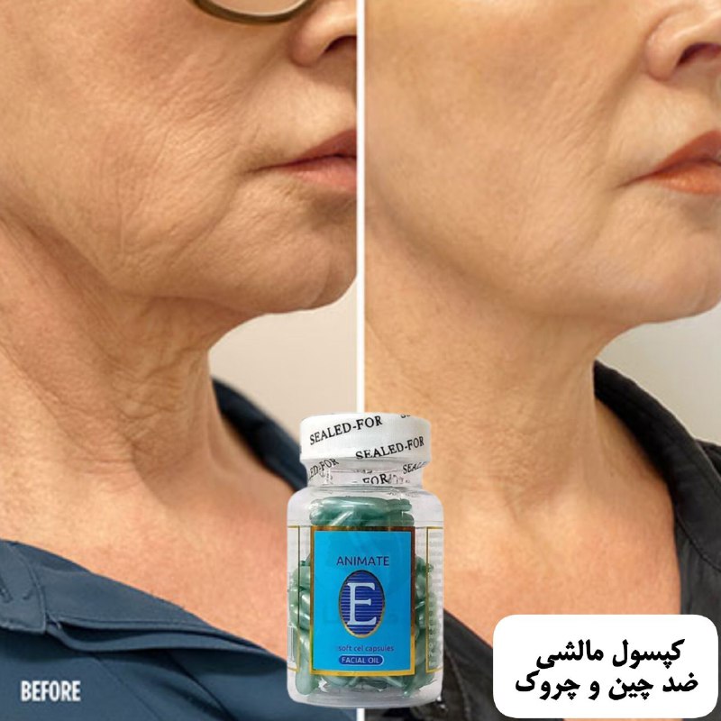 ***⭕️***کپسول مالشی رفع چین و چروک …