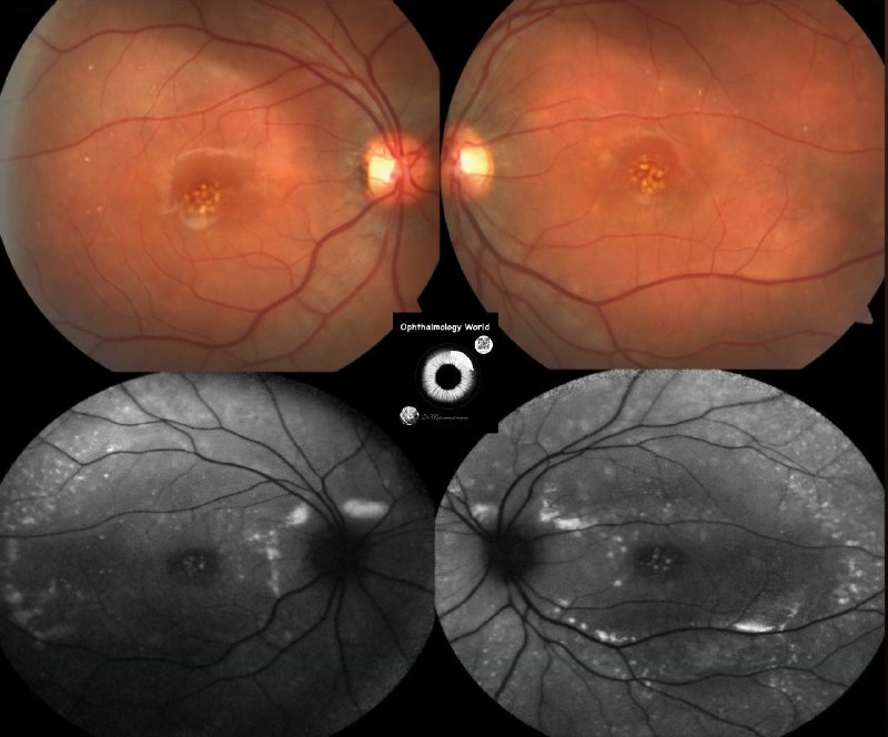 OPHTHALMOLOGY WORLD 👁️