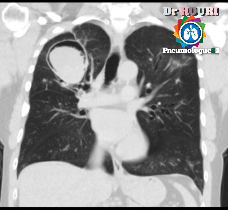 Radiographie thoracique دكتور حوري بلقاسم