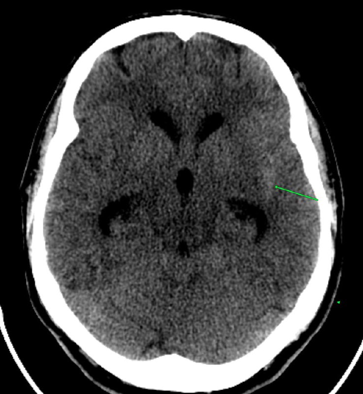 Radiology _in_my_life