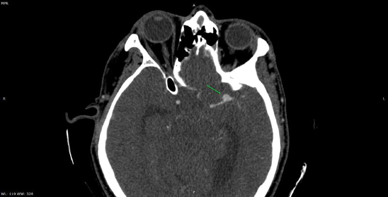 Radiology _in_my_life