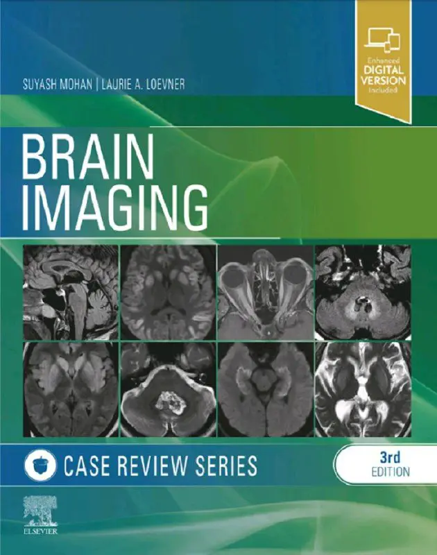 Brain Imaging, Case Review Series, 3rd …