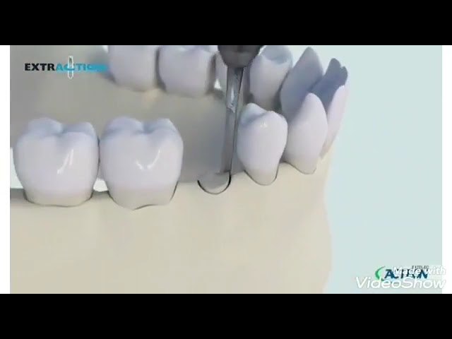 ملك طب الأسنان 🦷