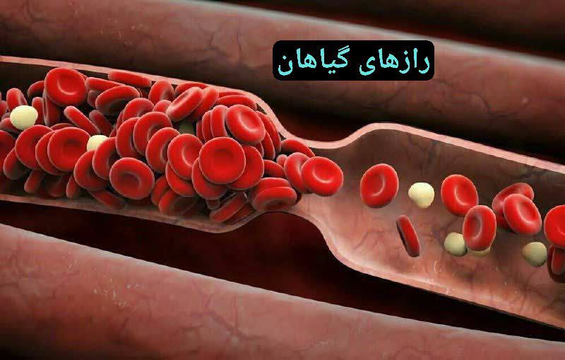 علائم وجود لخته خون در بدن …