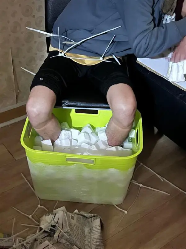 Man uses dry ice to amputate …