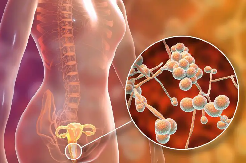 Post-Vaccine Vaginal Bleeding Rates Associated With All COVID-19 Vaccine Types Across Reproductive Ages