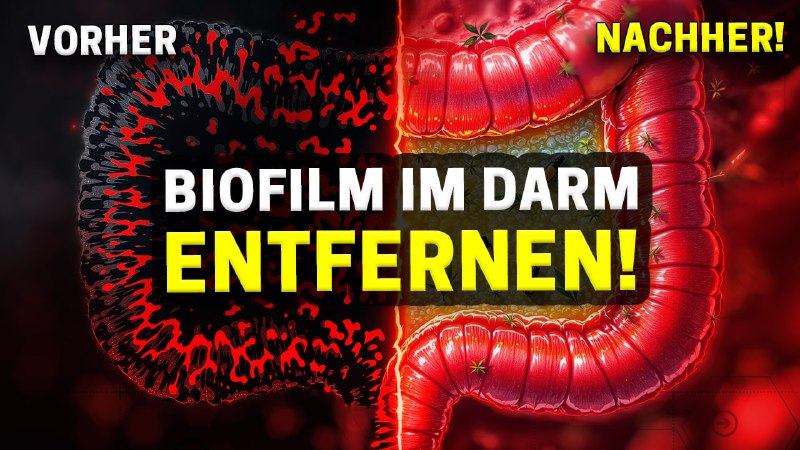 **Der Biofilm im Darm macht uns …