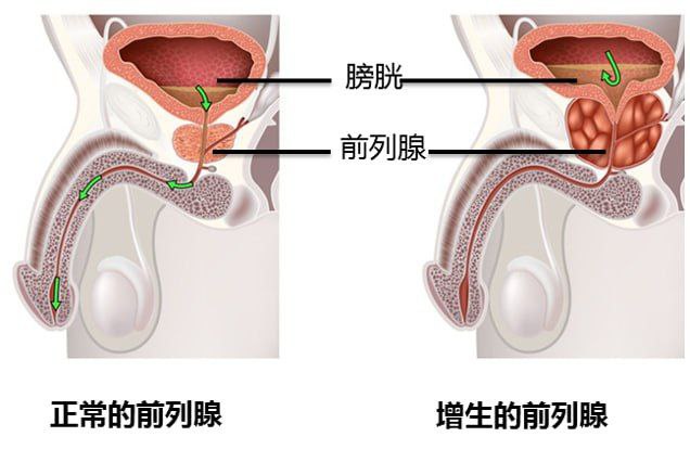 前列腺，隐秘处，