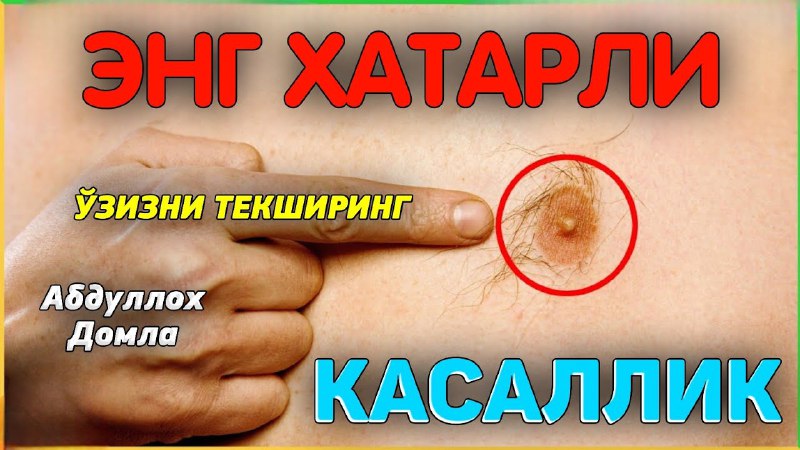 YouTubeda tomosha qiling: Энг хатарли касалликни …