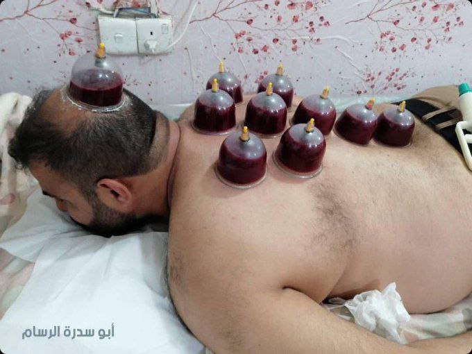 ٱلرُّقْيَةُ ٱلشَّرْعِيَةُ ?️ مُبَــــــــٰاشِرٌ