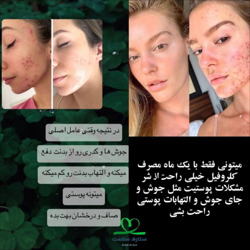 پیشنهاد من به شما معجزه طبیعت …