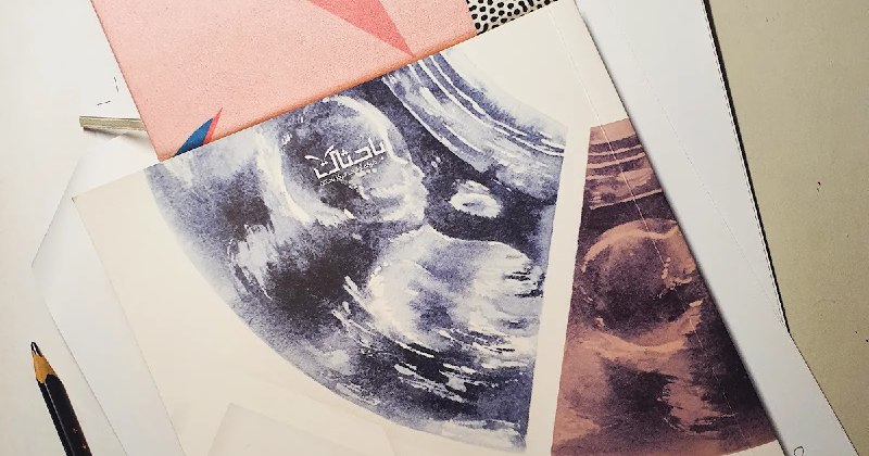 في مقال بديع بعنوان: "عبرة من …