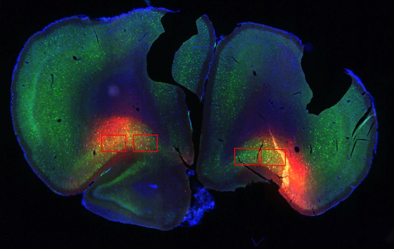 **This brain slice is so me …