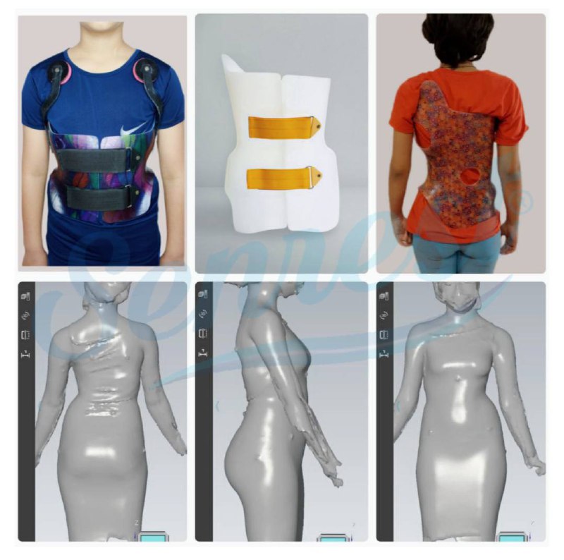 ***⚠️*****دیگر نگران کار تخصصی بریس های …