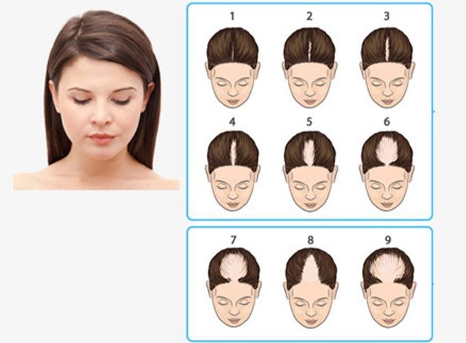 ویس پایین رو گوش بفرمایید!
