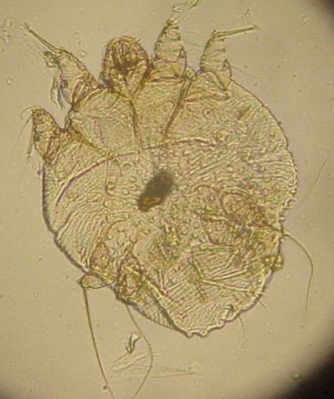 Sarcoptes scabei