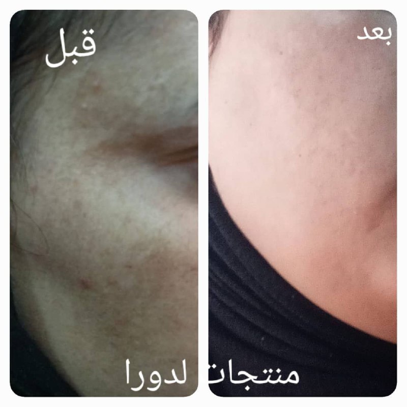 منتجات عشبية علاجيه